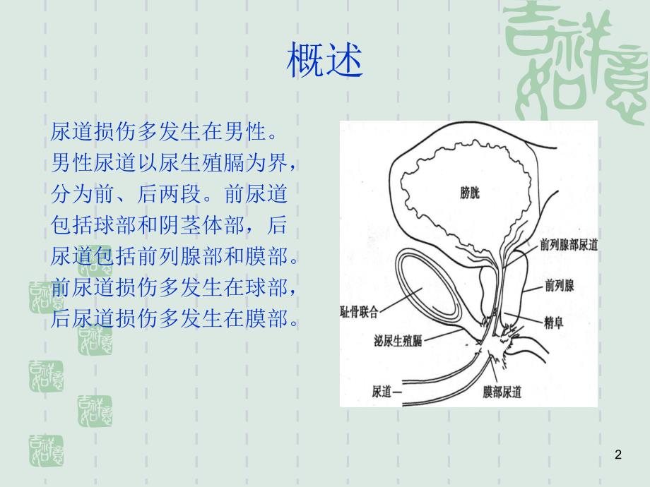 尿道损伤的治疗与护理PPT参考幻灯片.ppt_第2页