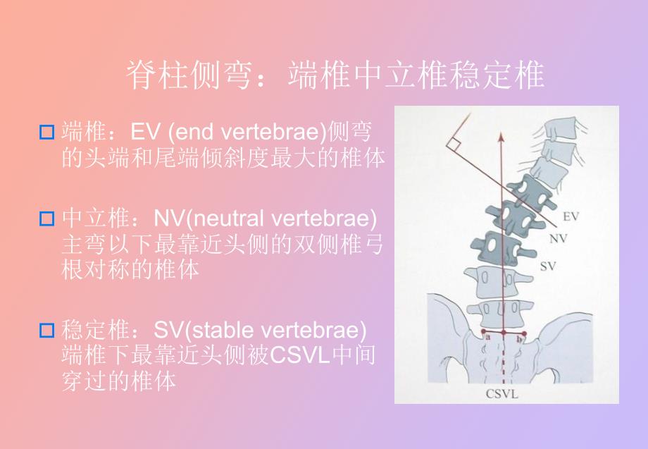 脊柱侧弯基础知识_第2页