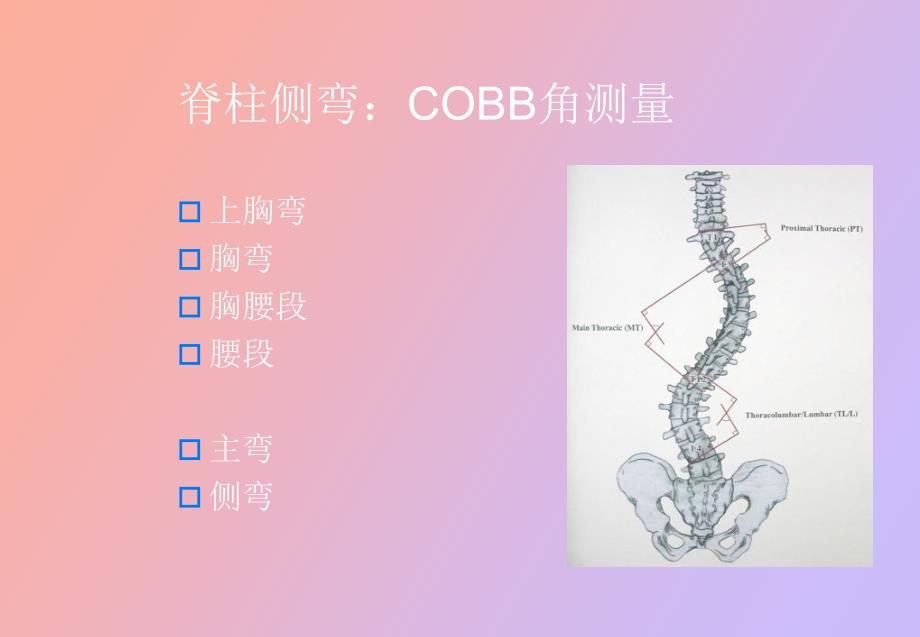 脊柱侧弯基础知识_第3页