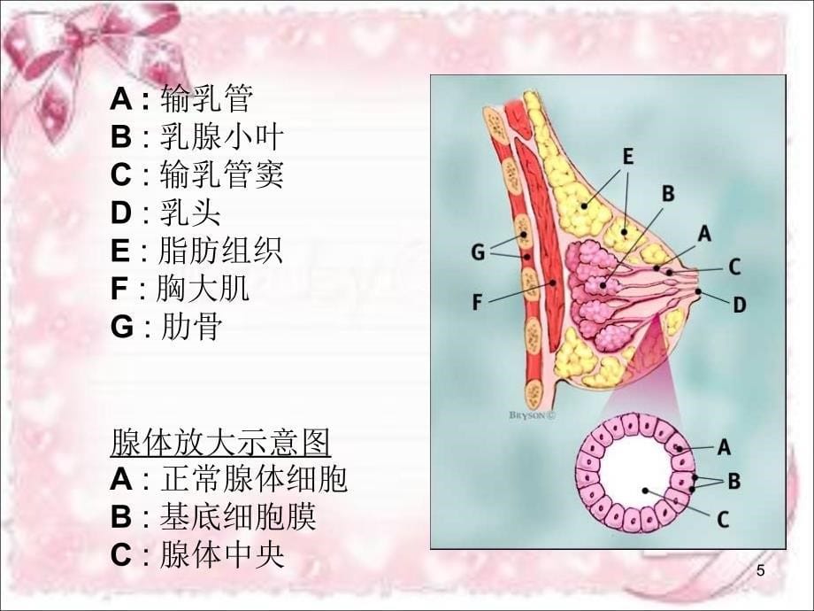 乳腺疾病的护理ppt课件_第5页