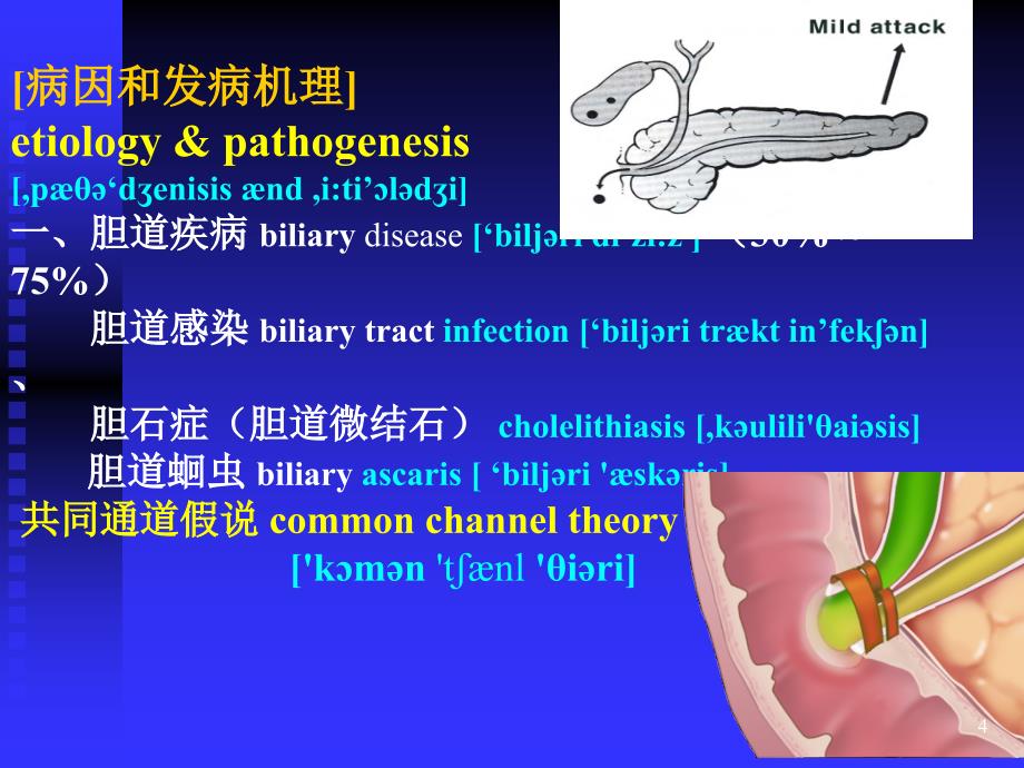 急性胰腺炎优精选幻灯片_第4页