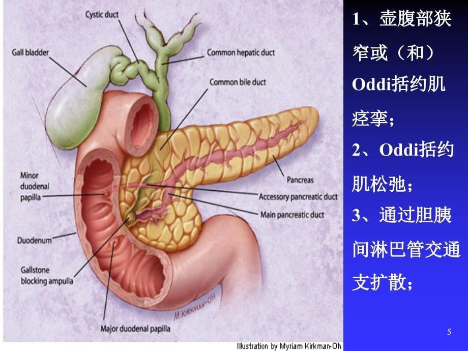 急性胰腺炎优精选幻灯片_第5页