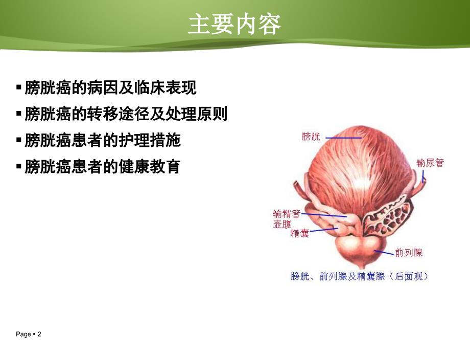 膀胱癌病人的护理及健康教育_第2页