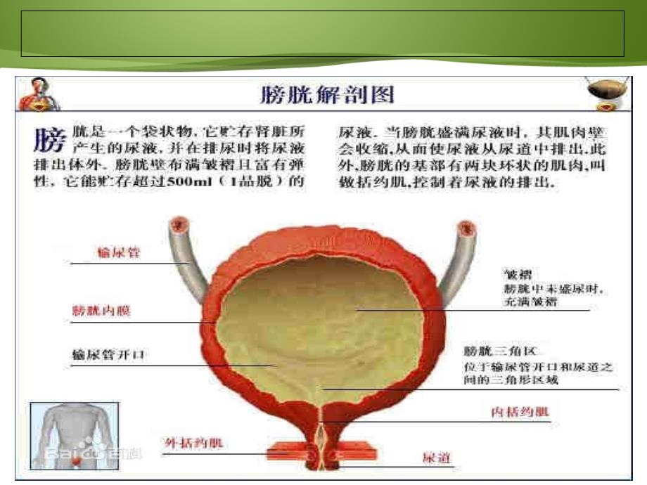 膀胱癌病人的护理及健康教育_第3页