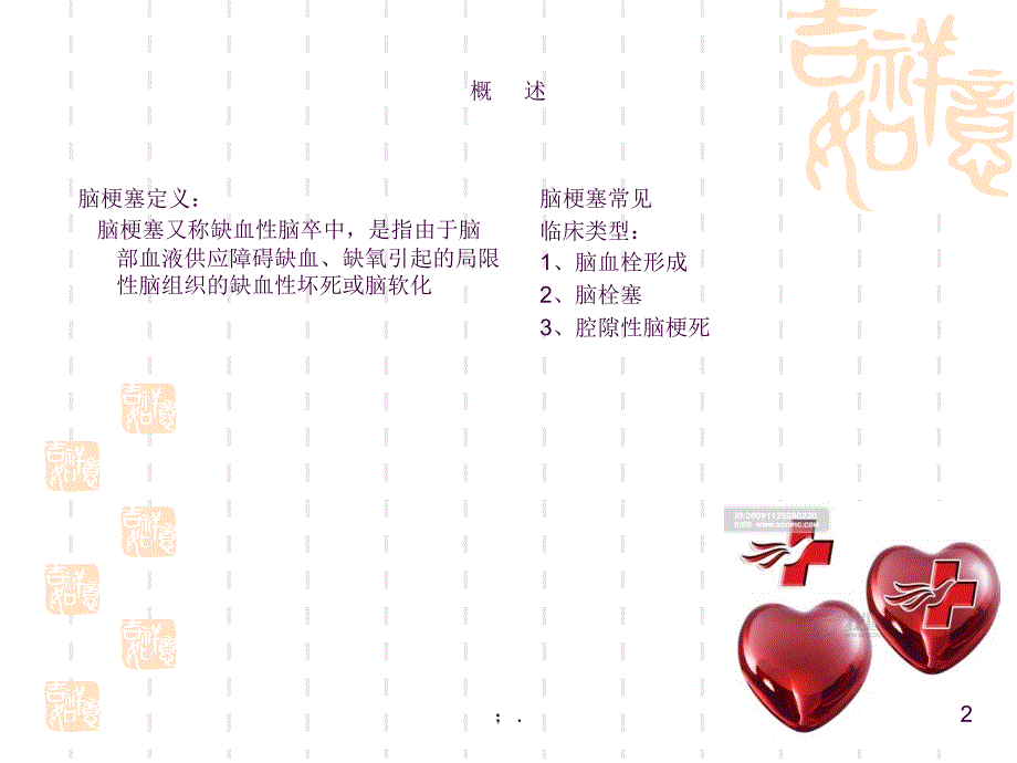 脑梗塞护理2ppt课件_第2页