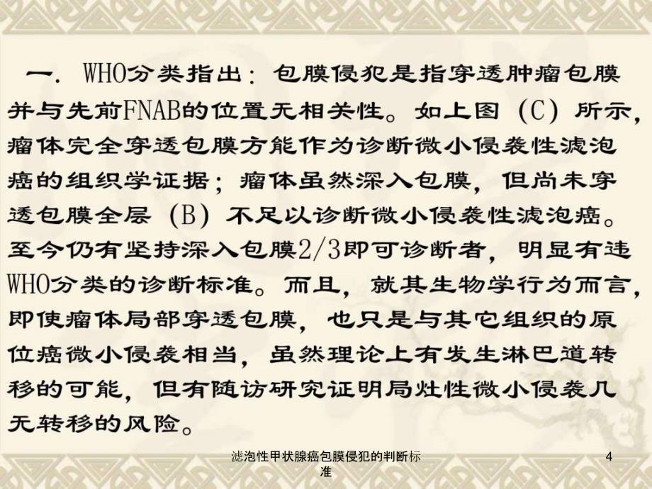 滤泡性甲状腺癌包膜侵犯的判断标准课件_第4页