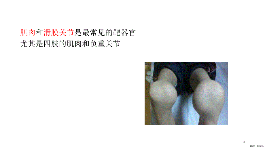 血友病关节炎PPT演示课件PPT37页_第3页