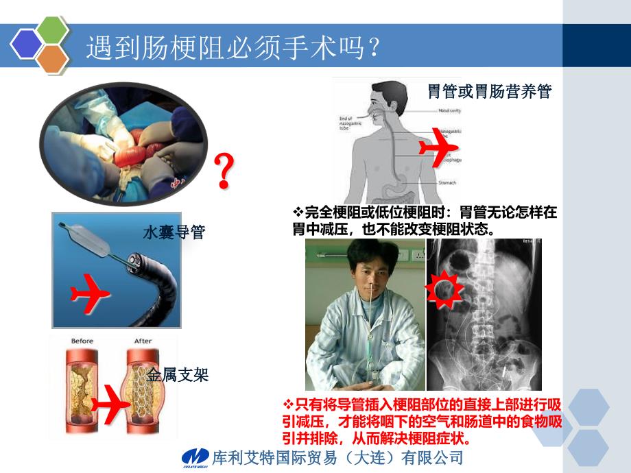 临床科室肠梗阻导管使用护理讲座培训深圳_第4页