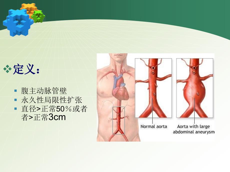 腹主动脉瘤的护理讲课_第4页