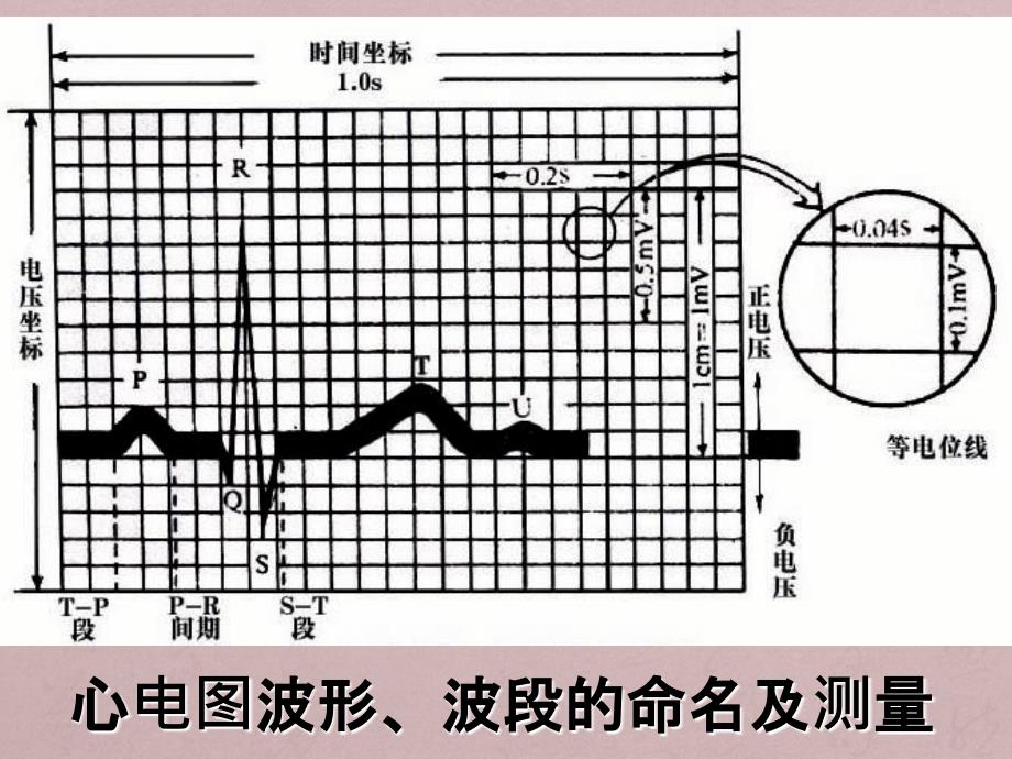 异常心电图图谱_第3页