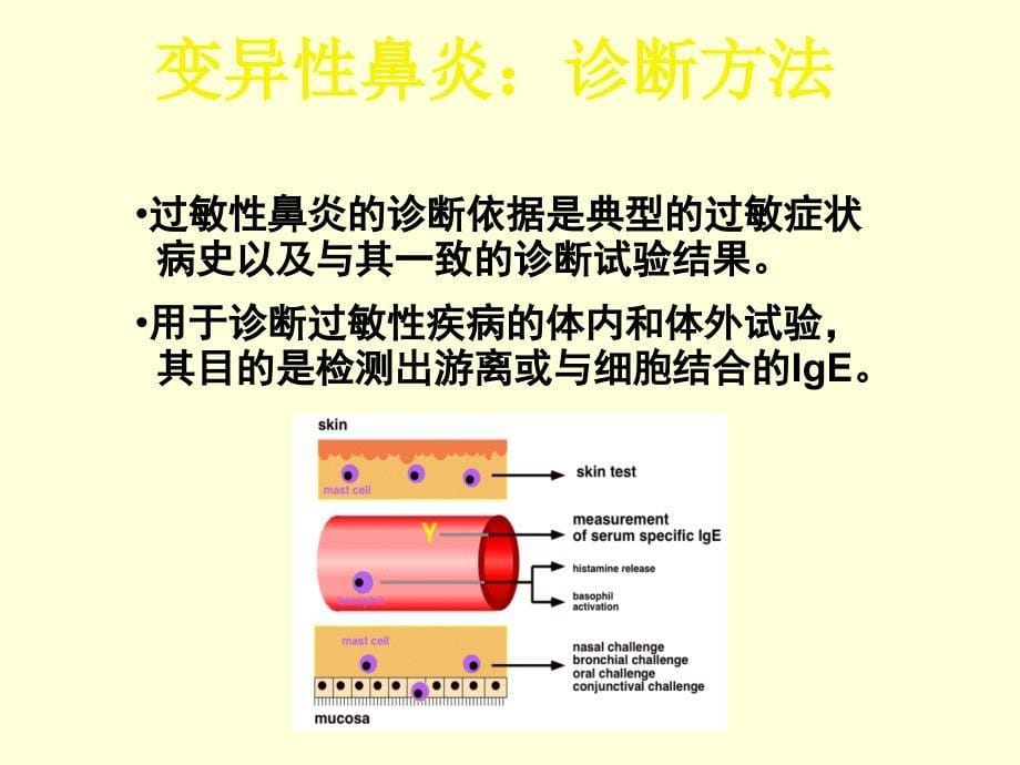 变应性鼻炎的诊断与治疗PPT课件021_第5页