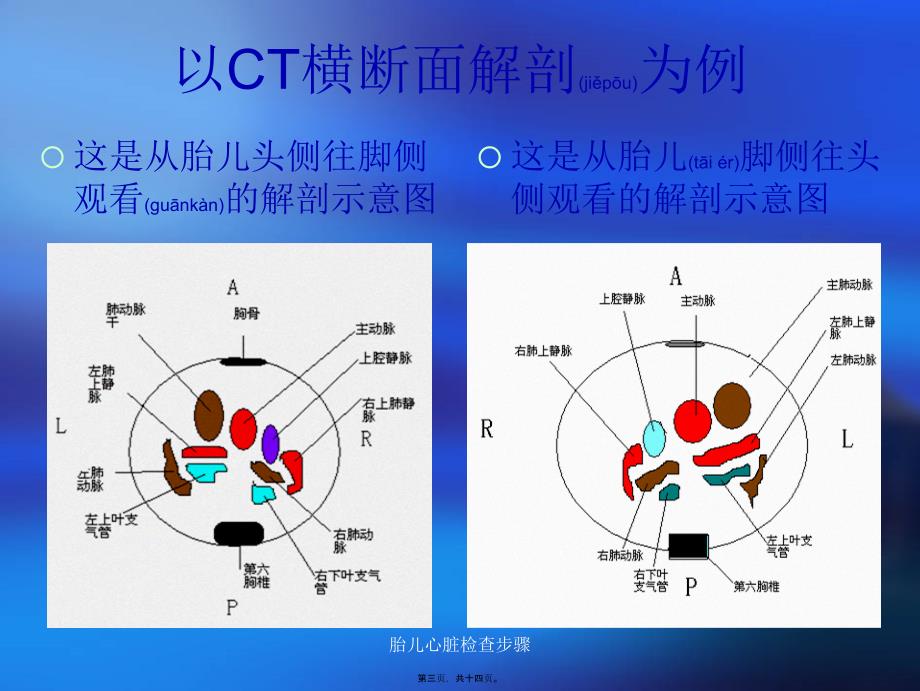 胎儿心脏检查步骤课件_第3页