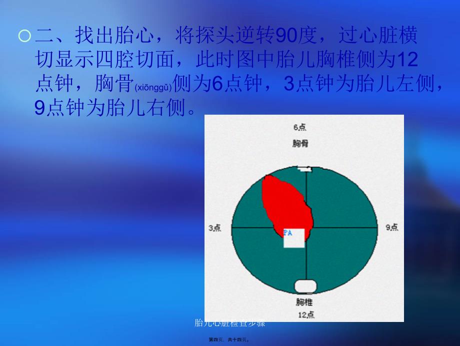 胎儿心脏检查步骤课件_第4页