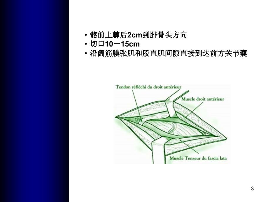 全髋关节置换手术入路文档资料_第3页