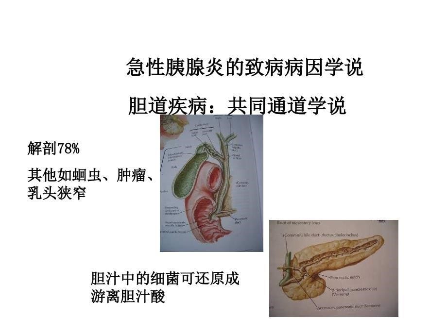 普外胰腺疾病ppt课件_第5页