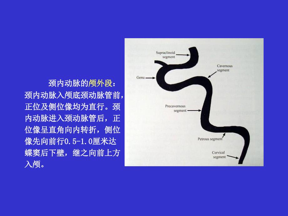 颅内血管解剖及其影像表现课件_第4页