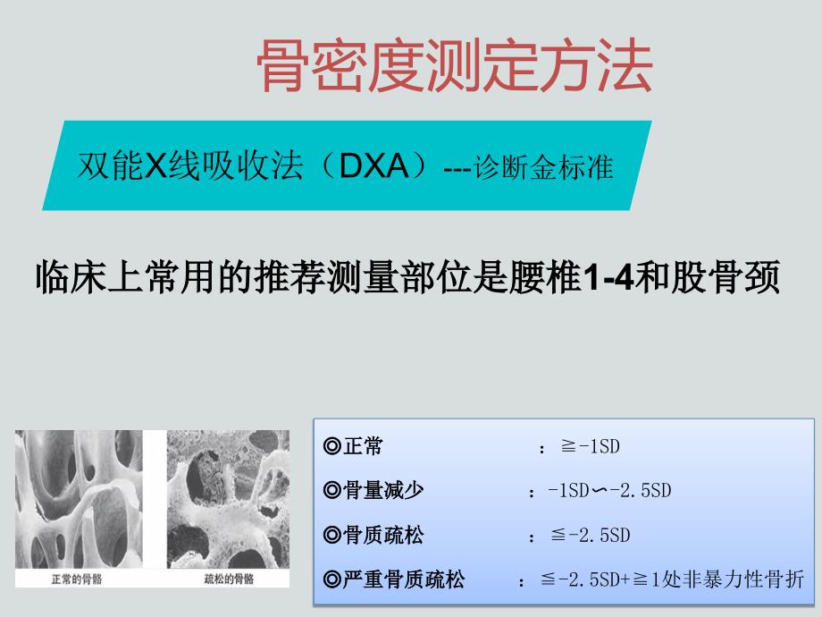 老年骨质疏松的防治_第4页