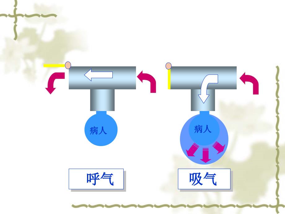 新生儿常用呼吸机及参数调节_第4页