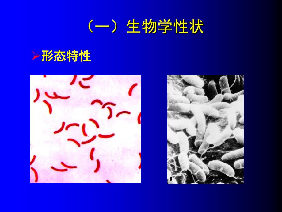 医学微生物学：16章弧菌属_第4页