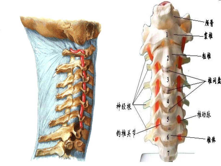 脊髓型颈椎病患者的个案护理查房ppt课件_第2页