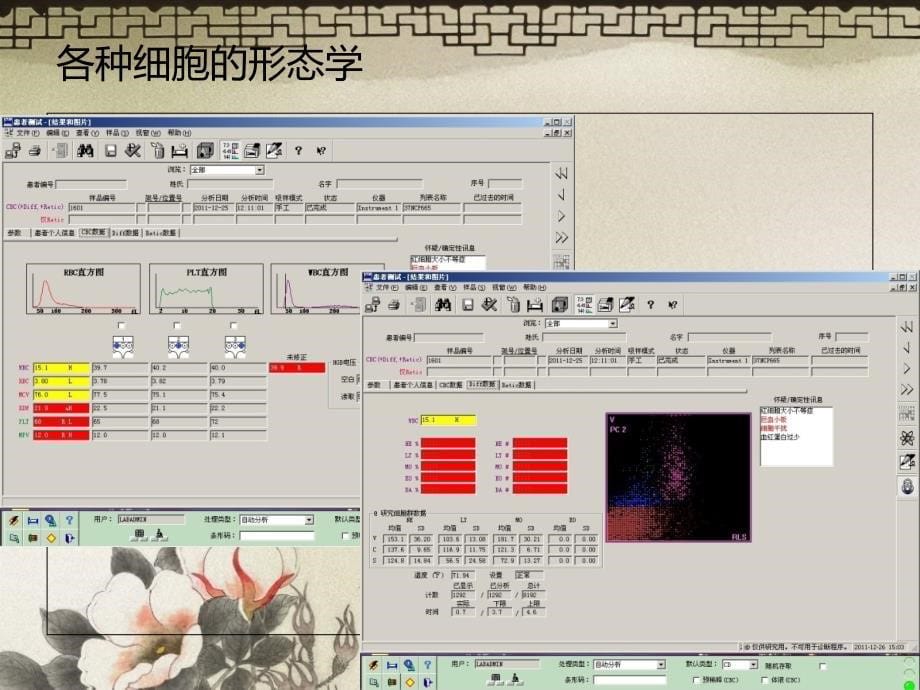 血常规检查及镜检11_第5页