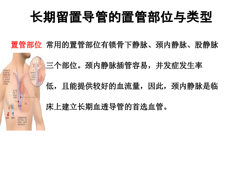 血液透析长期静脉导管并发症的原因与护理_第4页