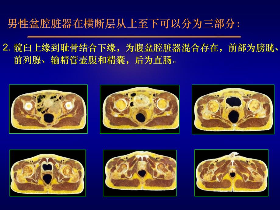 男性盆腔连续横断层解剖ppt课件_第3页