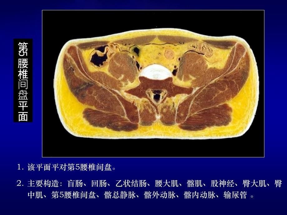 男性盆腔连续横断层解剖ppt课件_第5页