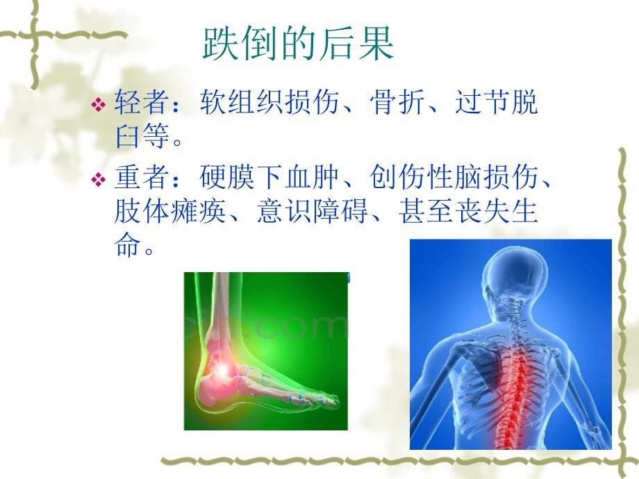 老年人跌倒的预防与护理_第5页