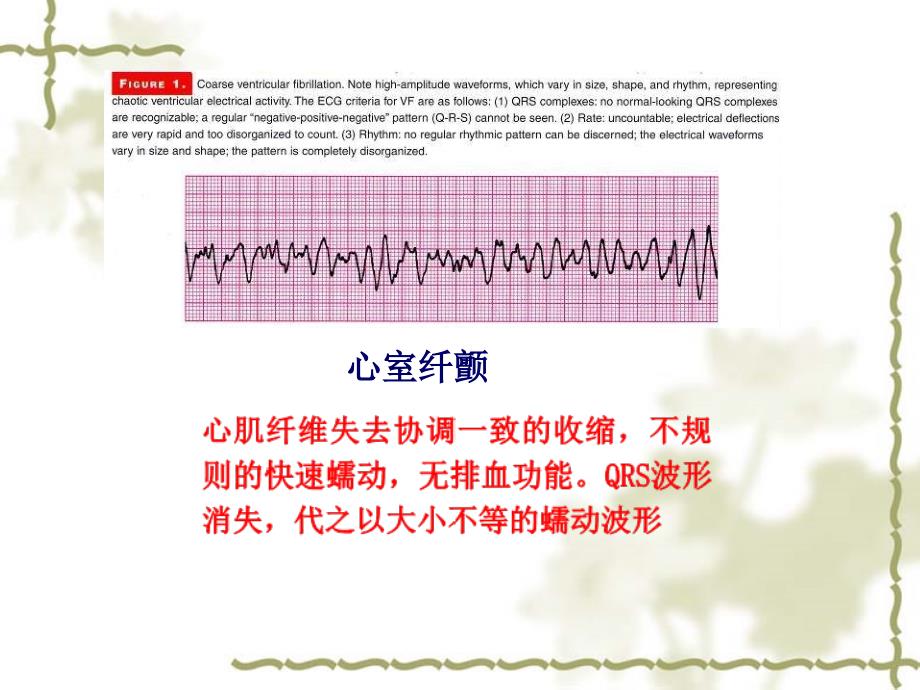 开心脏按压技术PPT课件_第4页