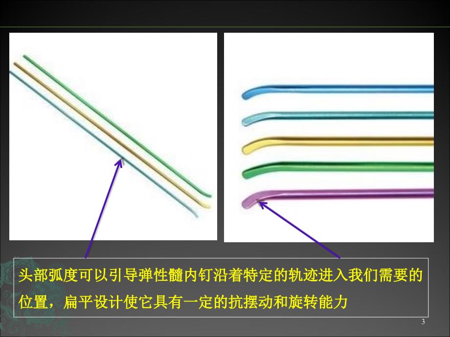 儿童长骨骨折弹性髓内钉ppt课件_第3页