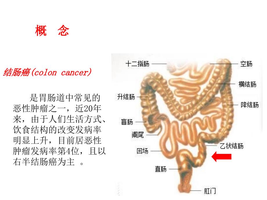 结肠癌护理查房科室讲课PPT课件_第4页