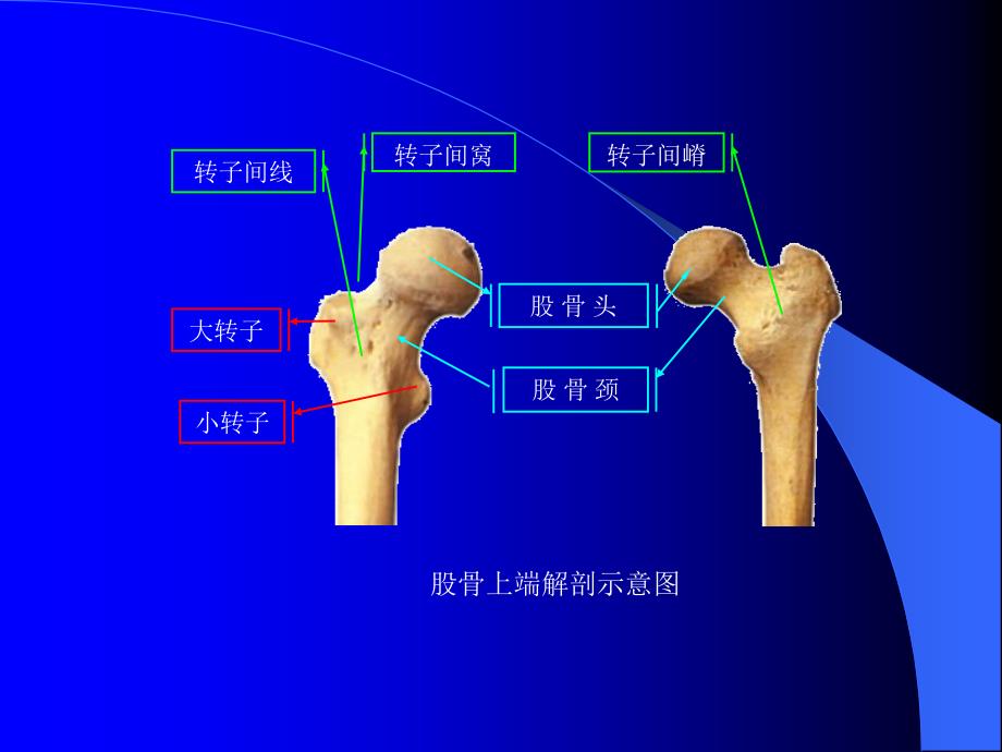 股骨转子间骨折(定稿)_第4页