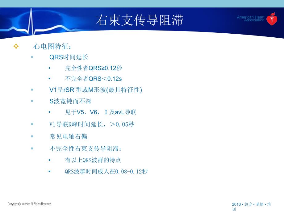 《束支传导阻滞》PPT课件_第3页