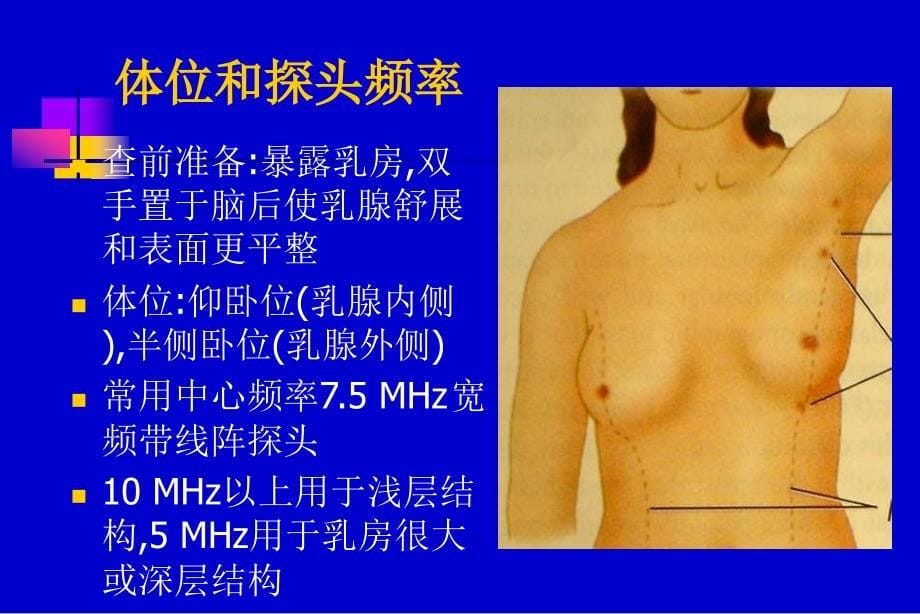 乳腺超声PPT课件_第5页