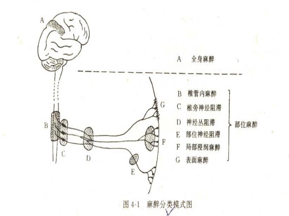 麻醉基础知识与术后护理_第4页