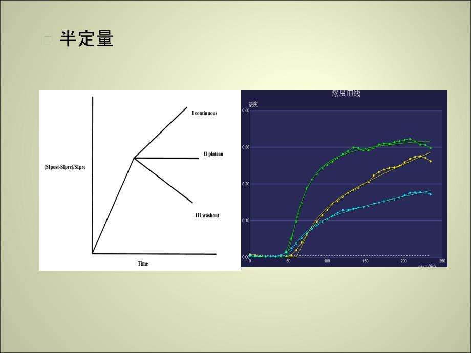 前列腺MR动态增强.ppt_第3页