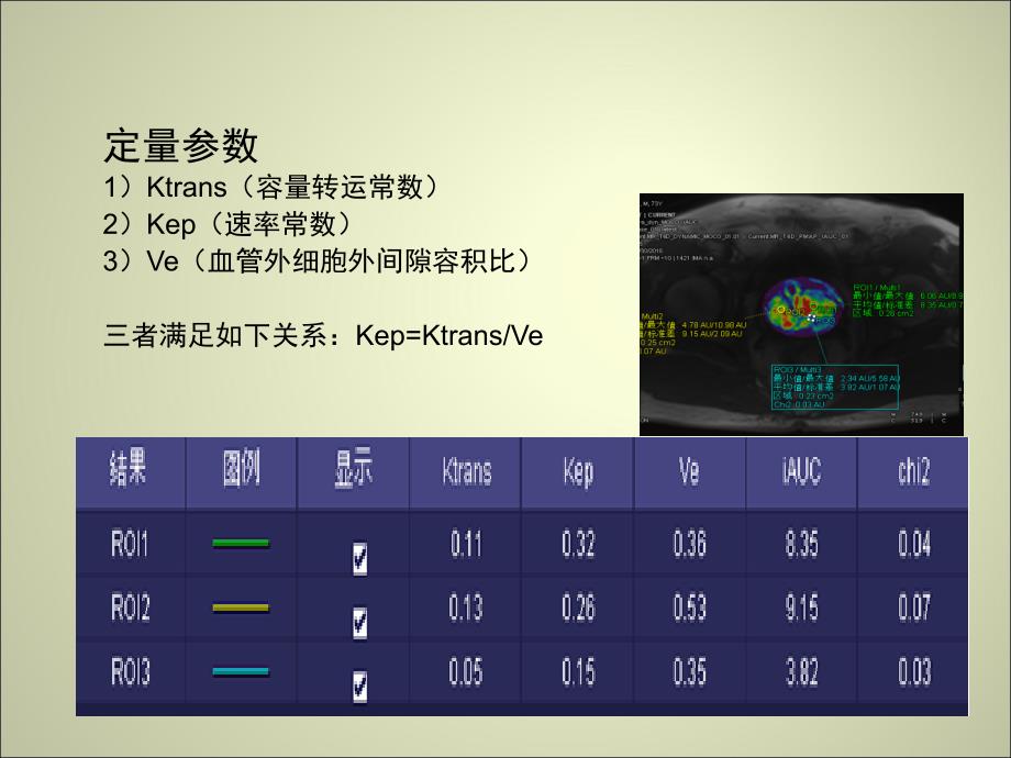 前列腺MR动态增强.ppt_第4页