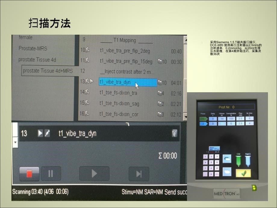 前列腺MR动态增强.ppt_第5页