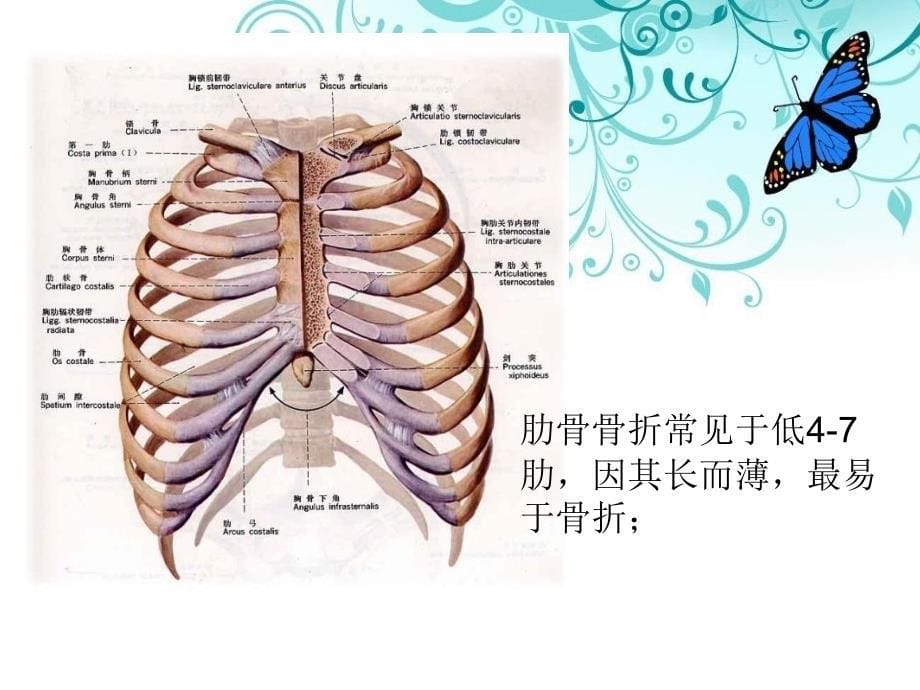 ICU肋骨骨折护理查房解析_第5页