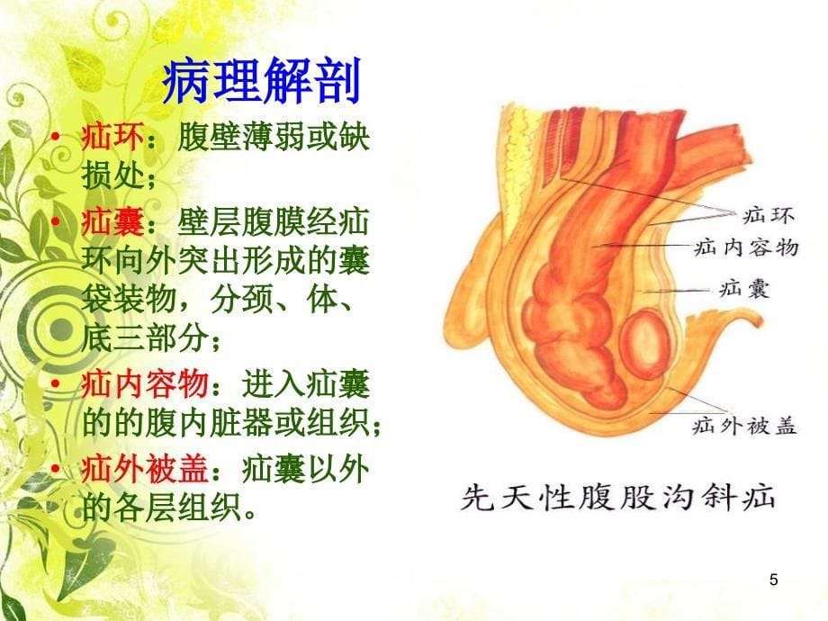 腹外疝病人的护理优秀课件_第5页