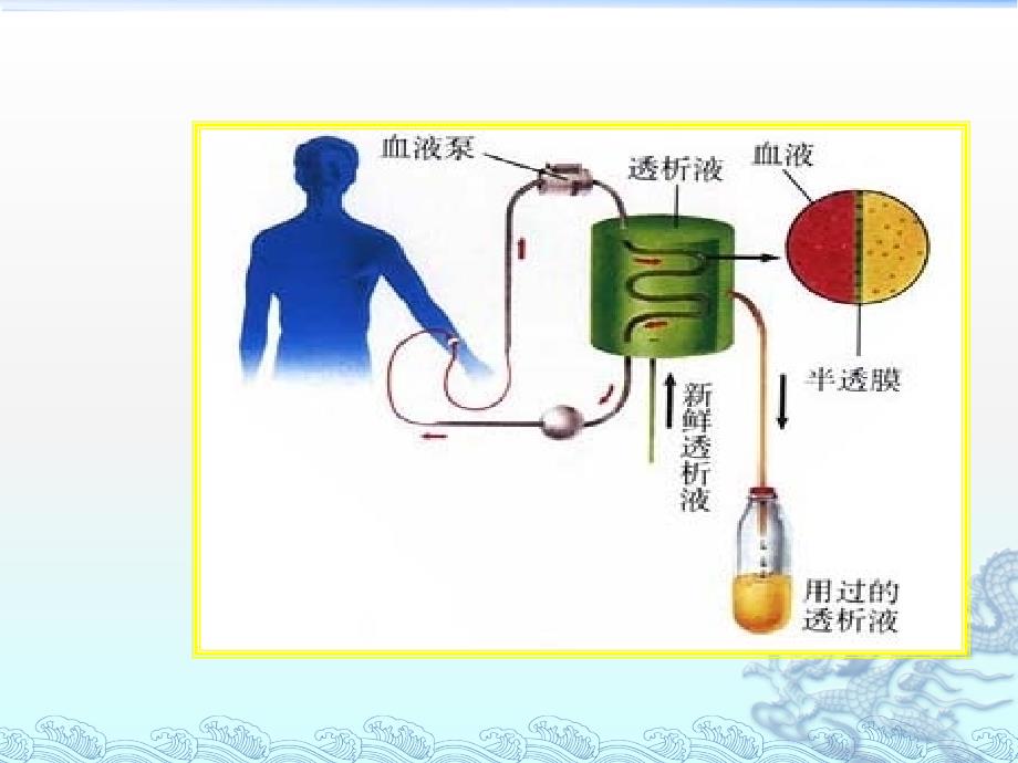 血液净化的原理_第4页