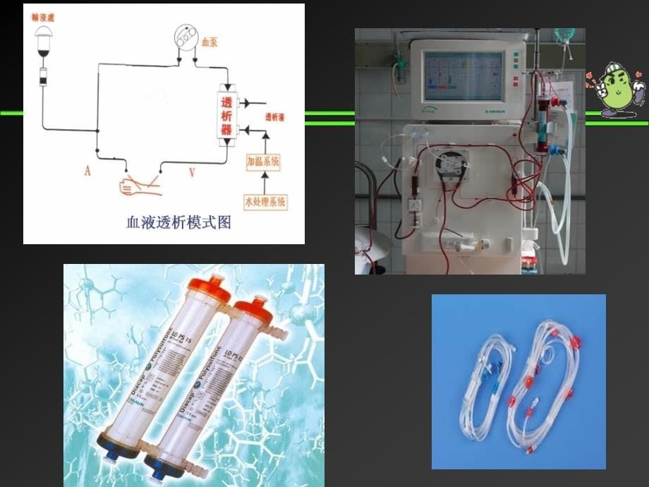 血液透析急性并发症及其处理课件_第5页