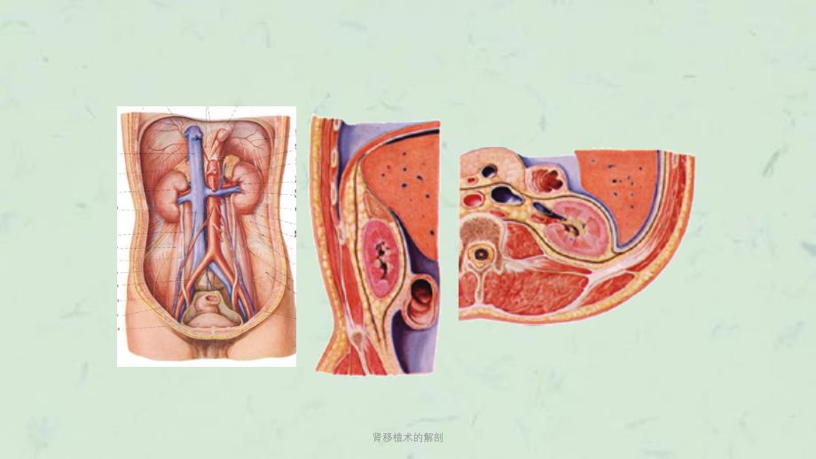 肾移植术的解剖课件_第2页