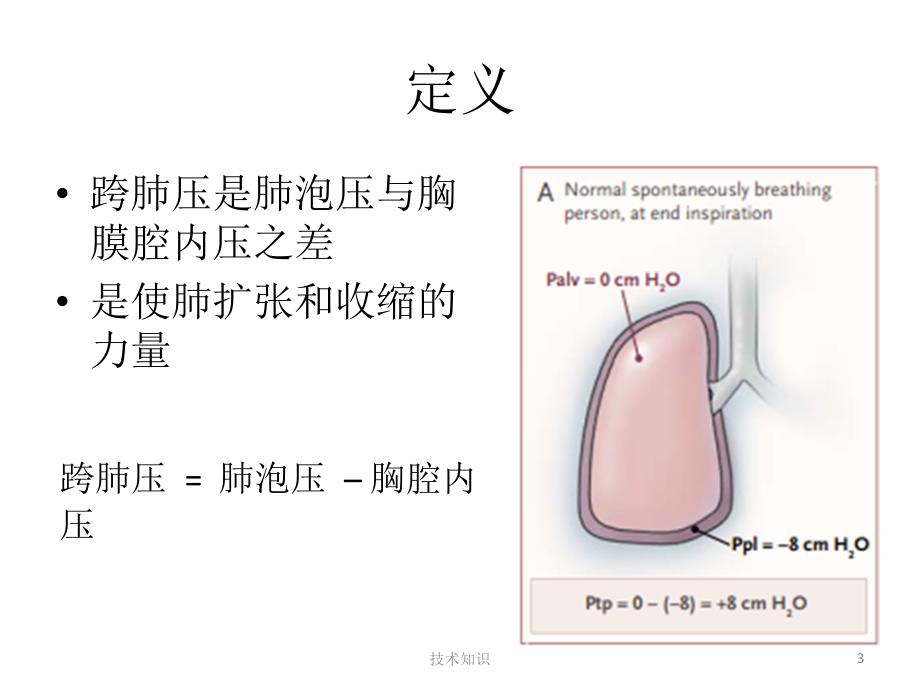 跨肺压wc【行业相关】_第3页