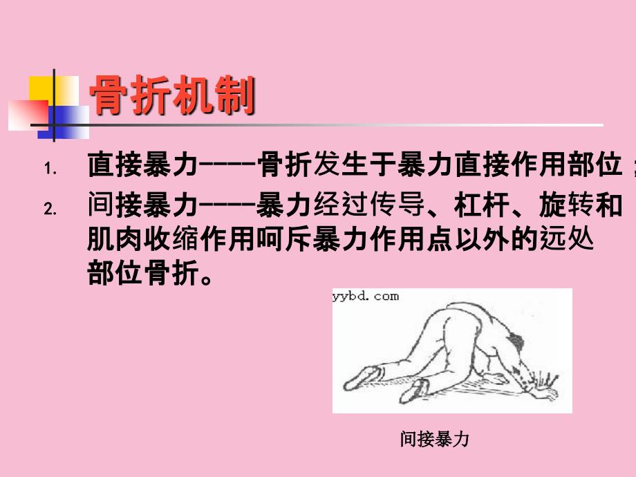 骨折患者护理ppt课件_第4页