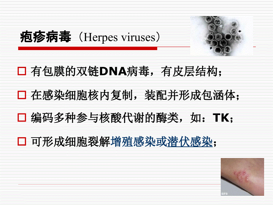 医学微生物学课件：27 疱疹病毒_第2页