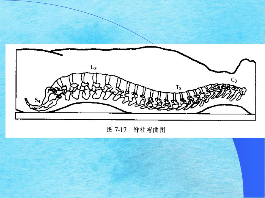 临床医学椎管内麻醉ppt课件_第4页