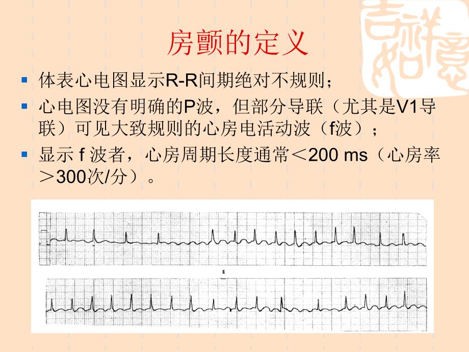 最新房颤治疗指南_第2页