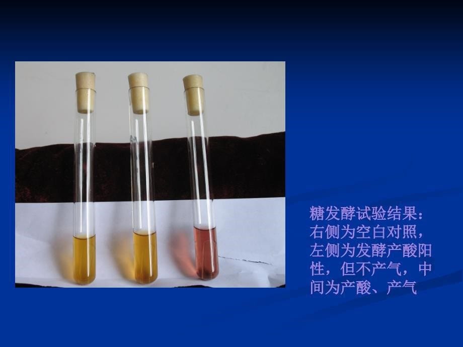 微生物实验六糖发酵实验_第5页